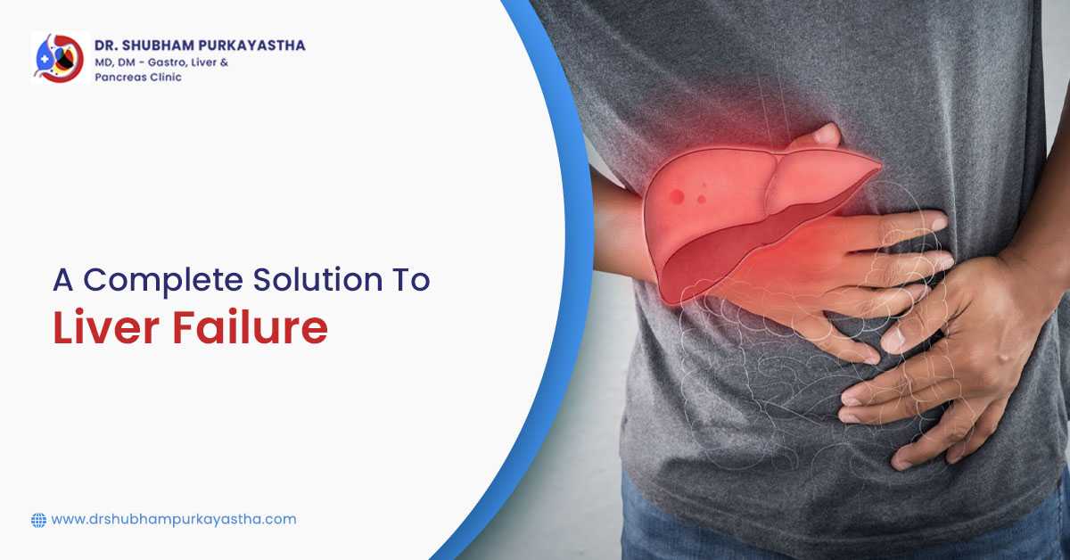 A Complete Solution To Liver Failure